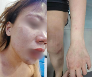 Bị chồng bạo hành dã man, vợ gọi cho người yêu cũ để cầu cứu và cái kết bất ngờ gây xôn xao dư luận