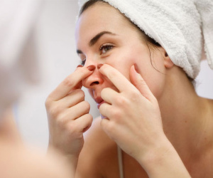 Mụn đầu đen và 6 thói quen sai lầm cần tránh khi chăm sóc tại nhà