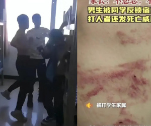 Quên mang sách, bé trai bị giáo viên dùng thước đánh khiến đầu biến dạng, rơi vào trầm cảm