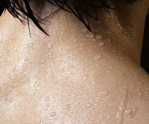 Trời nóng dễ đổ mồ hôi nhưng bác sĩ nhắc nhở 7 kiểu này là bệnh, gồm cả ung thư