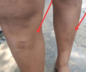 Vụ 5 cháu nhỏ bị hàng xóm đánh bầm dập: Chuyển hồ sơ lên Công an TP Buôn Ma Thuột