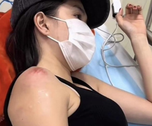 Ngọc Trinh hé lộ số tiền 6 lần điều trị chấn thương do tai nạn mô tô