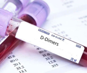 Bộ Y tế chính thức lên tiếng về thông tin 'xét nghiệm đông máu sau tiêm vắc xin AstraZeneca'