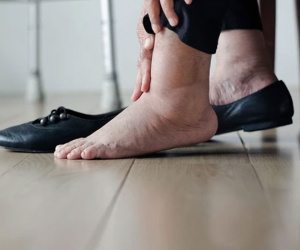 Khi thận suy hỏng, bàn chân có thể xuất hiện 6 điểm bất thường