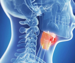Khàn tiếng kéo dài 3 tháng, người đàn ông ở Hà Nội bất ngờ khi nhận kết quả chẩn đoán