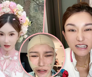 Bỏ ra gần 5 tỷ đồng phẫu thuật thẩm mỹ nhưng gặp biến chứng, KOL khiến hơn 2,2 triệu fan 'sốc' nặng
