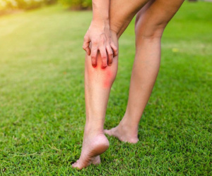 Cụ bà phải cắt cụt hai chân chỉ vì côn trùng đốt