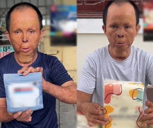 Chuyện cảm động về người cha bị biến dạng khuôn mặt vẫn kiên trì livestream bán hàng, nuôi 4 con ăn học