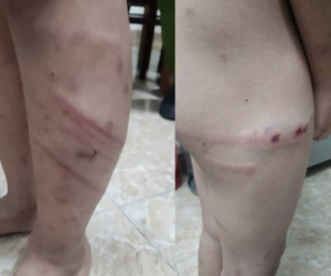 Điều tra vụ việc bé trai 11 tuổi nghi bị mẹ và bạn trai bạo hành dã man