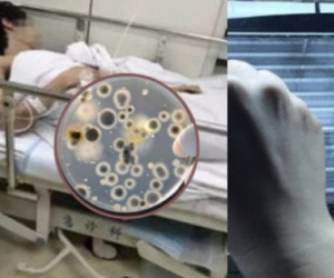 Người đàn ông nhiễm 'vi khuẩn chết người' từ điều hòa, đừng xem nhẹ những tác nhân tàn phá cả gan, thận và phổi