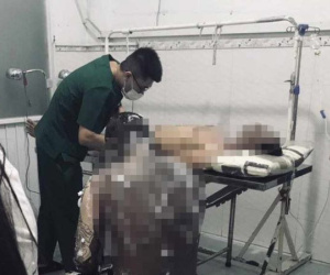 Nổ bồn bụi trong công ty gỗ, nhiều công nhân bỏng nặng