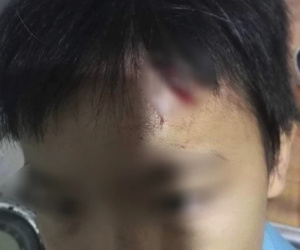 Điều tra vụ bé trai 10 tuổi nghi bị mẹ kế tiếp tục bạo hành