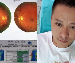 Sao nam từng gặp tai nạn nghiêm trọng, bị xuất huyết bên trong gây suy giảm thị lực