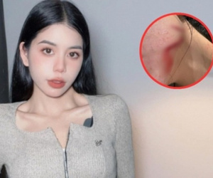 Đã có kết quả kiểm tra loạt thương tích của Hằng Du Mục