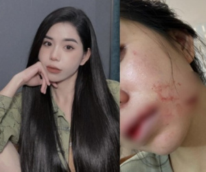Vụ Hằng Du Mục bị bạo hành: Người chồng được tại ngoại sau 2 ngày gây ra chuyện phẫn nộ