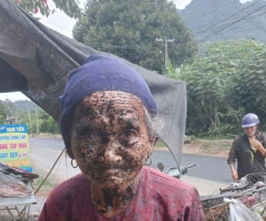 Thanh Hóa: Cụ già bị đơn vị thi công phun nhựa đường vào mặt