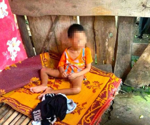 Bé 5 tuổi có nhiều vết thương bị đưa ra ở riêng trong lán tạm