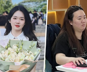 Căng thẳng vì áp lực công việc, cô gái bỗng 'phát phì' thêm 20kg