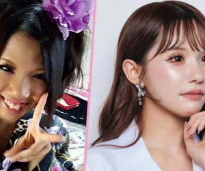 Cô gái 'đổi đầu' ngoạn mục sau hơn 20 cuộc phẫu thuật với số tiền 4 tỷ đồng: 'Tôi làm tất cả chỉ để sống'