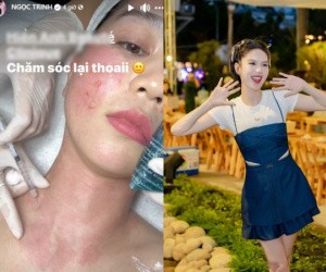 Nhan sắc hiện tại của Ngọc Trinh sau khi công khai thẩm mỹ