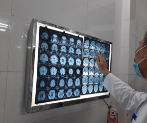 Tưởng mắc u não, người phụ nữ Thái Bình khóc hết nước mắt: Kết quả phát hiện nguyên nhân bất ngờ