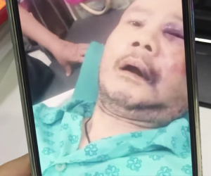 Ca sĩ Tô Thanh Phương nằm viện, tiết lộ lý do nhảy lầu: 'Tôi bị sốc, sợ bị mù'
