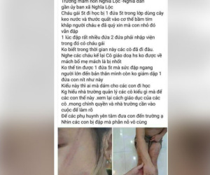 Nhiều trẻ mầm non bị bạn đánh bầm tím cơ thể tại lớp học