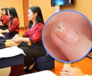 Bé trai phải cắt bỏ ngón tay sau khi bố đưa đến tiệm nail để chữa nấm móng tay