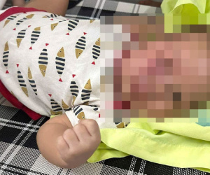 Công an vào cuộc vụ cháu bé 3 tháng tuổi bị đánh bầm tím mặt