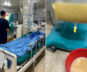 Bác sĩ không thể tin nguyên nhân khiến người đàn ông cấp cứu trong đêm