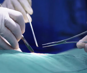 Bệnh nhân cần phẫu thuật tay, bác sĩ mổ nhầm lưỡi