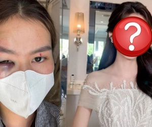 Vụ đi trang điểm đám cưới, thợ makeup tố bị em gái cô dâu 'tương tác' bầm tím mắt: Hai bên nói gì?