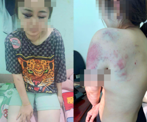 Người đàn ông đánh vợ sắp cưới suốt 13 tiếng: Hé lộ nguồn cơn