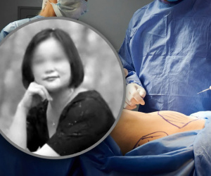 Tử vong vì thực hiện 6 ca phẫu thuật thẩm mỹ trong 24h