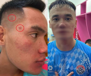 Cầu thủ hạng Nhất không xin lỗi Xuân Nam sau vụ ẩu đả, CLB tính kháng cáo án phạt của VFF