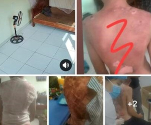 Vĩnh Phúc: Công an điều tra vụ bé trai bị bỏng nặng nghi do mẹ kế dội nước sôi