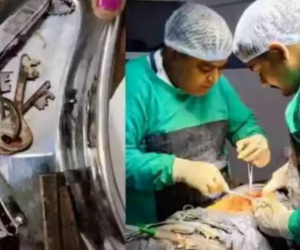 Cứu sống thanh niên 22 tuổi nuốt vào bụng cả dao, chìa khóa và bấm móng tay
