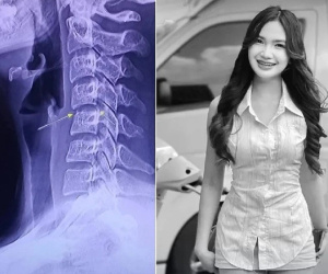 Lời khai của nhân viên massage 'bẻ cổ' cho nữ ca sĩ Thái Lan