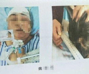 Thương tâm: Chứng kiến mẹ gặp tai nạn, con gái sốc đến mức liên tục hét 'Con phải cứu mẹ' suốt 5 ngày rồi qua đời