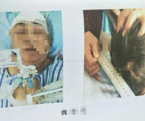 Thương tâm: Chứng kiến mẹ gặp tai nạn, con gái sốc đến mức liên tục hét 'Con phải cứu mẹ' suốt 5 ngày rồi qua đời