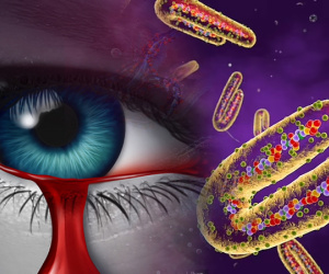 WHO cảnh báo về loại virus mới gây chảy máu mắt ở Tanzania khiến 8 người tử vong