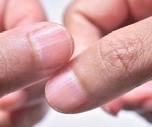 Đàn ông có thận khoẻ sẽ không bị đen ở 3 bộ phận này