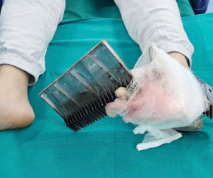 Bé trai bị kẹp chân vào thang cuốn trung tâm thương mại