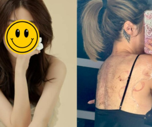 Sao nữ Vbiz đang điều trị trầm cảm: Cập nhật tình hình sức khỏe đáng chú ý