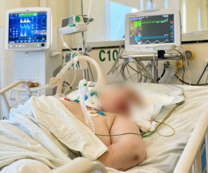 Mổ não cấp cứu người phụ nữ trẻ sau bữa nhậu