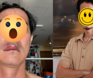 Sao nam Vbiz phát hoảng vì mặt biến dạng, sưng phồng bất thường