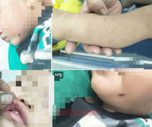 Nữ giáo viên đánh trẻ dã man: Kết quả điều tra ban đầu từ Công an Quảng Nam