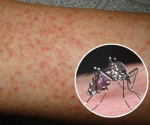 Cô gái 28 tuổi ở Vũng Tàu tử vong do sốt xuất huyết