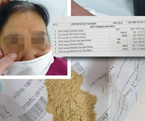 Cụ bà 70 tuổi suy thận cấp vì dùng thuốc mua qua mạng