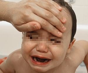 Trẻ em đang gặp những vấn đề sức khỏe nào thì không nên tiêm vắc xin sởi?